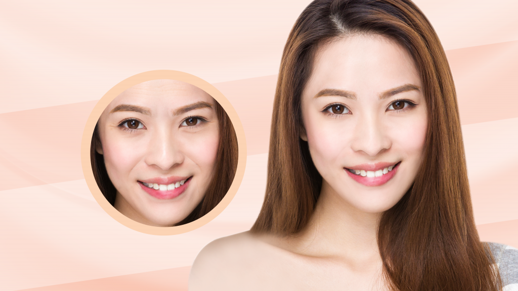 drkyo_website_Wrinkles_FA_wrinkles_01